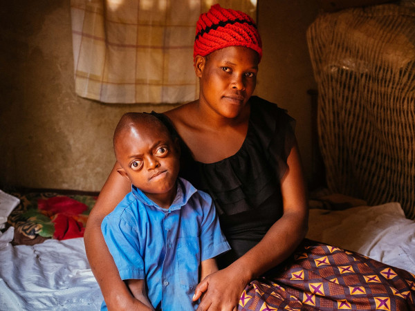 Аномалии тела