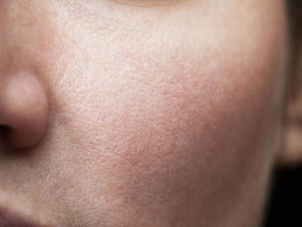 Почему мы краснеем